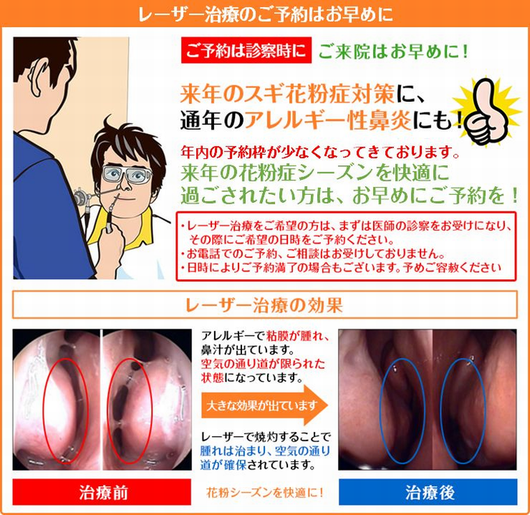 レーザー治療の受付に関して